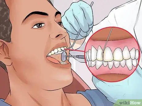 Imagem intitulada File Down Dentures Step 8