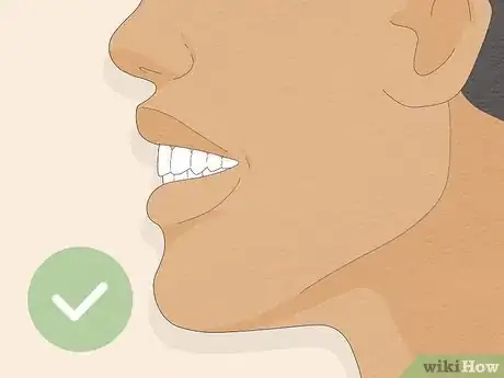 Imagem intitulada Fix an Overbite Step 3