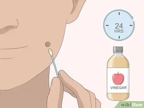 Imagem intitulada Remove Moles Quickly Step 9