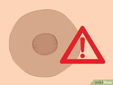 Imagem intitulada Remove a Nipple Piercing Step 2