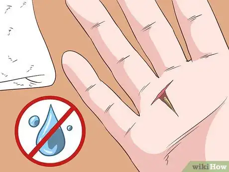 Imagem intitulada Remove a Deep Splinter Step 11