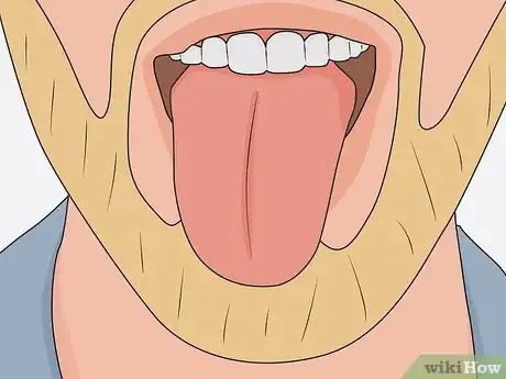 Imagem intitulada Identify CSF Rhinorrhea Step 3