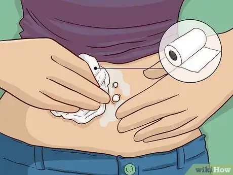 Imagem intitulada Clean a Body Piercing Step 4