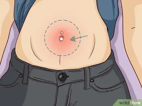 Imagem intitulada Clean a Body Piercing Step 8