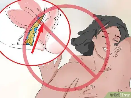 Imagem intitulada Use a Condom Step 25