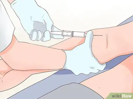 Imagem intitulada Recognize Syphilis Symptoms Step 9