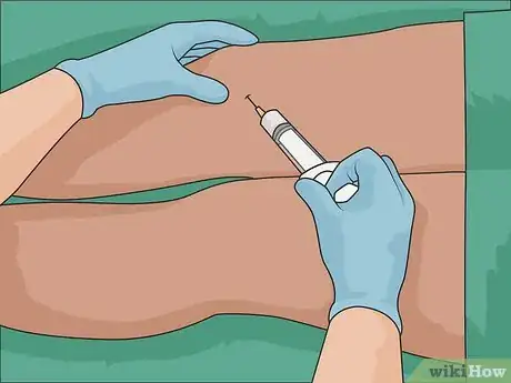 Imagem intitulada Remove Scars on Legs Step 20