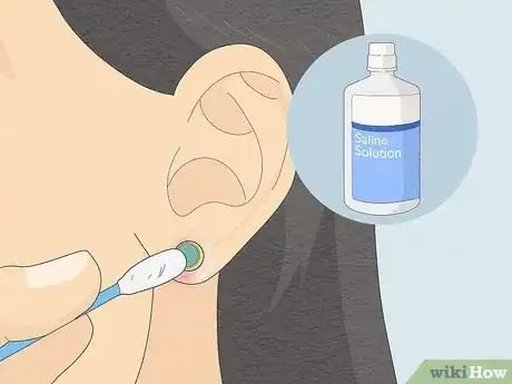 Imagem intitulada Clean Your Ear Piercing Step 6
