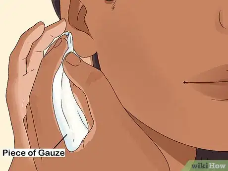 Imagem intitulada Clean a Cartilage Piercing Step 3