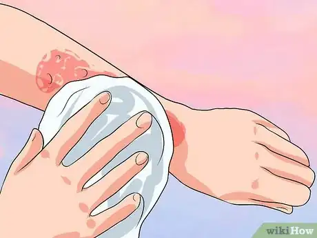Imagem intitulada Lessen Fiberglass Itch Step 3