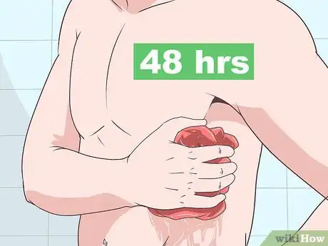 Imagem intitulada Treat Bruised Ribs Step 6