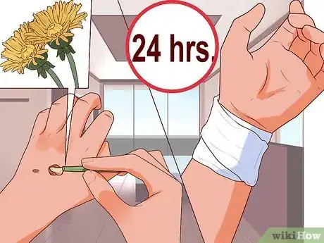 Imagem intitulada Remove Warts Naturally Using Garlic Step 9