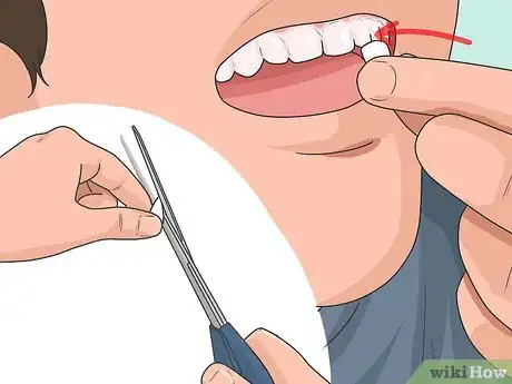 Imagem intitulada Make Vampire Fangs Step 4