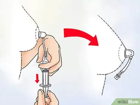 Imagem intitulada Get Rid of Inverted Nipples Step 10