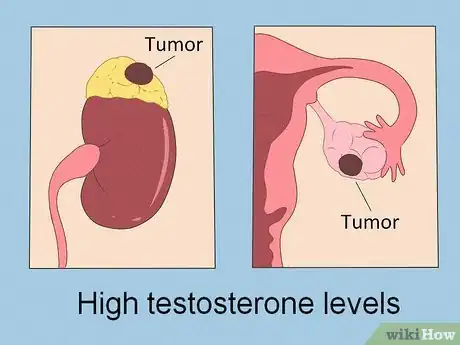 Imagem intitulada Lower Testosterone Levels Step 8