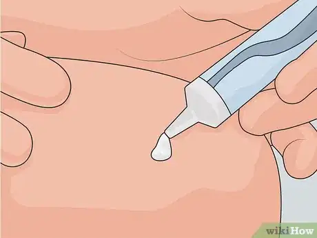 Imagem intitulada Remove Scars on Legs Step 13