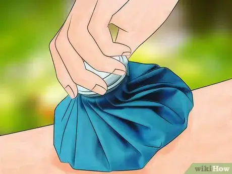 Imagem intitulada Identify Insect Bites Step 11
