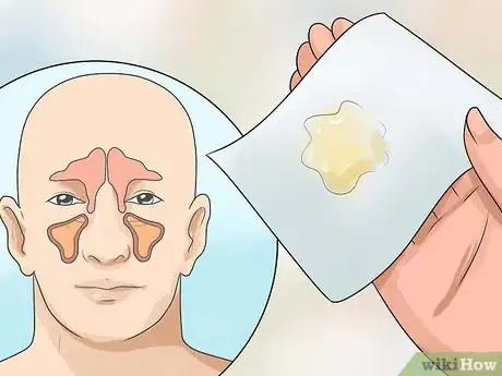 Imagem intitulada Get Rid of Mucus Step 2