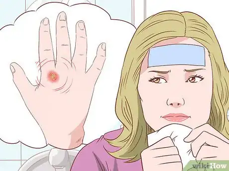 Imagem intitulada Remove a Splinter Step 11