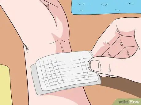 Imagem intitulada Get Rid of an Abscess Step 5