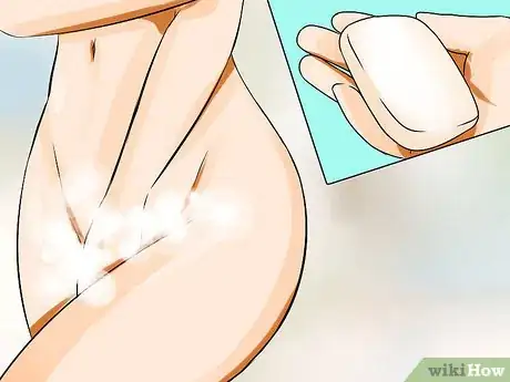 Imagem intitulada Cure Vaginal Infections Without Using Medications Step 31