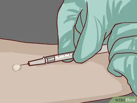 Imagem intitulada Read a Tuberculosis Skin Test Step 1