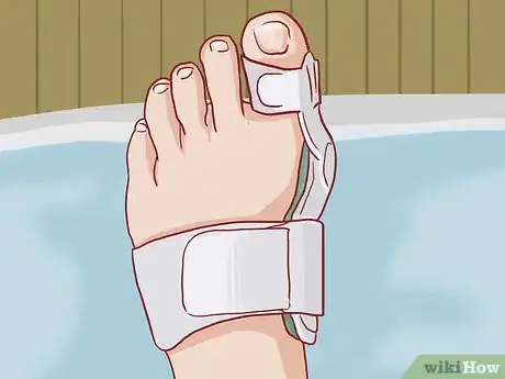 Imagem intitulada Straighten Toes Step 9