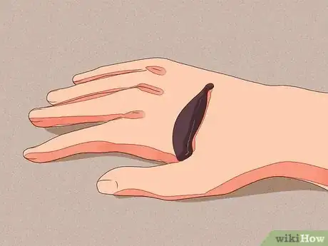 Imagem intitulada Remove Leeches Step 4