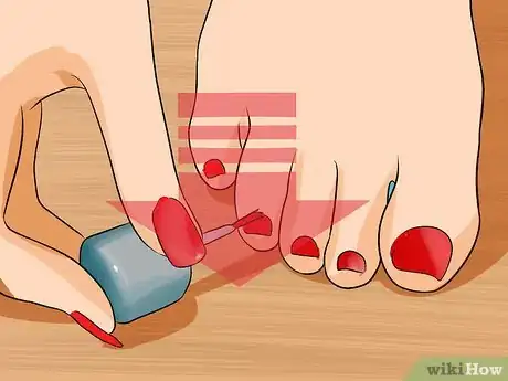 Imagem intitulada Get Rid of Yellow Toenails Step 7