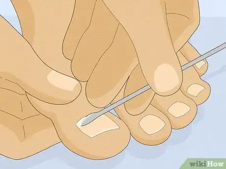 Imagem intitulada Have Pretty Toenails Step 10