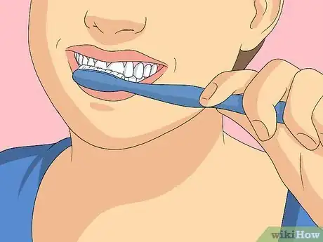 Imagem intitulada Clean Invisalign Step 14
