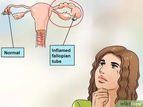 Imagem intitulada Cure Vaginal Infections Without Using Medications Step 10