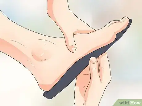 Imagem intitulada Get Rid of Shin Splints Fast Step 11