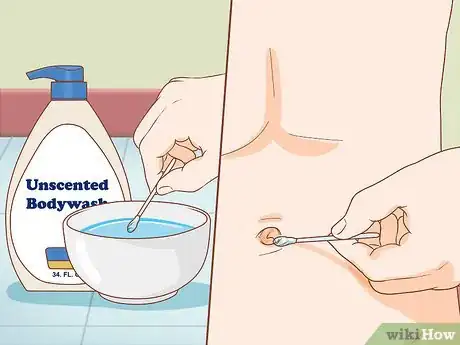 Imagem intitulada Clean Your Belly Button Step 3