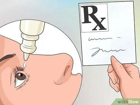 Imagem intitulada Get Rid of Pink Eye Fast Step 9