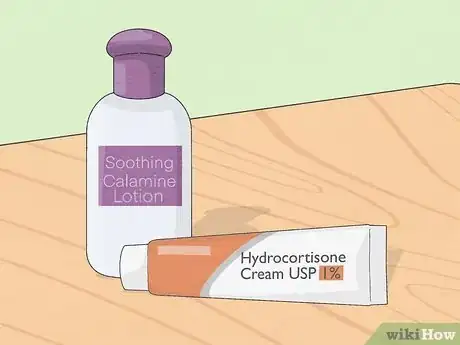 Imagem intitulada Recognize Scabies Rash Step 11