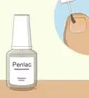 Curar Fungos nas Unhas com Vinagre