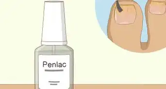 Curar Fungos nas Unhas com Vinagre