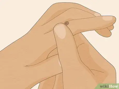 Imagem intitulada Identify Warts Step 5