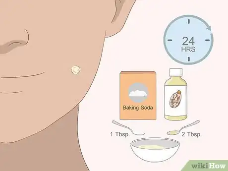 Imagem intitulada Remove Moles Quickly Step 14