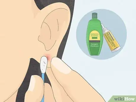 Imagem intitulada Clean Your Ear Piercing Step 10