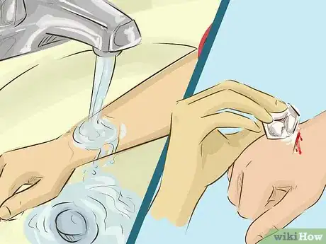 Imagem intitulada Stop Bleeding Step 1