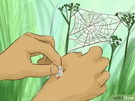 Imagem intitulada Stop Bleeding Step 7