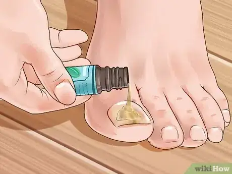 Imagem intitulada Use Essential Oils Step 7