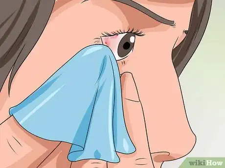 Imagem intitulada Get Rid of Pink Eye Fast Step 4