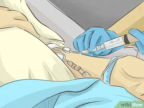 Imagem intitulada Go Into Labor Early Step 7