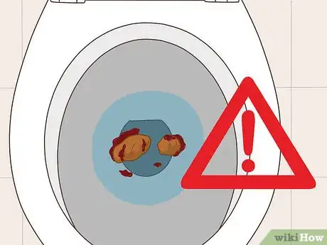 Imagem intitulada Detect Rectal Cancer Step 2