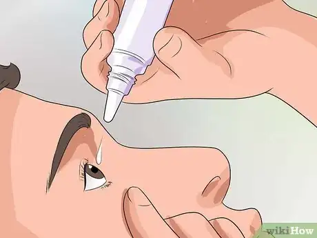Imagem intitulada Get Rid of Pink Eye Fast Step 5