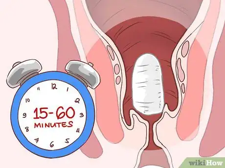 Imagem intitulada Insert a Rectal Suppository Step 10