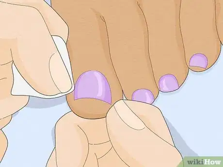 Imagem intitulada Have Pretty Toenails Step 14